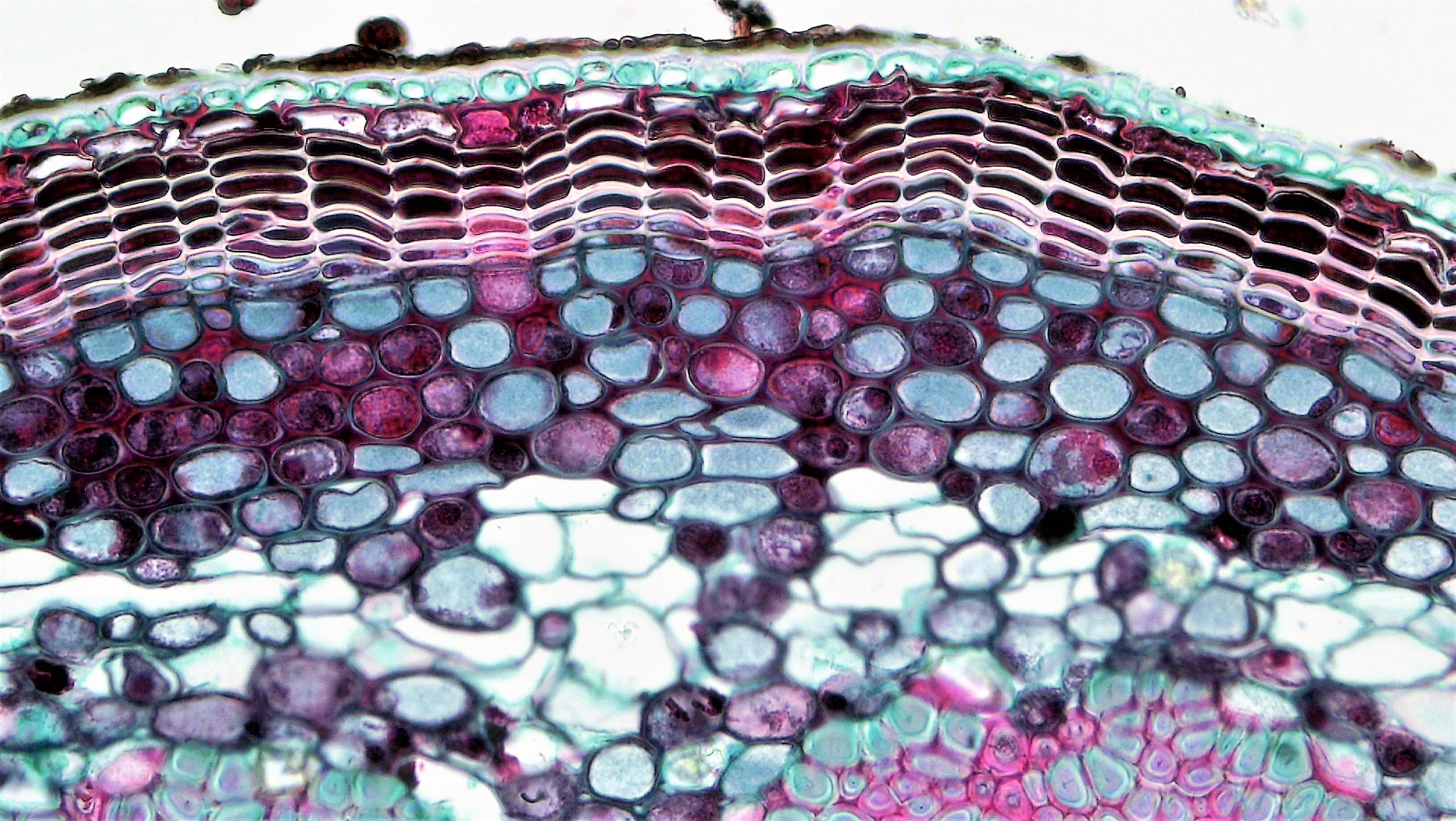 Клетки ксилемы живые. Ксилема микрофотография. Ксилема и флоэма под микроскопом. Ксилема микроскоп. Сосуды ксилемы под микроскопом.