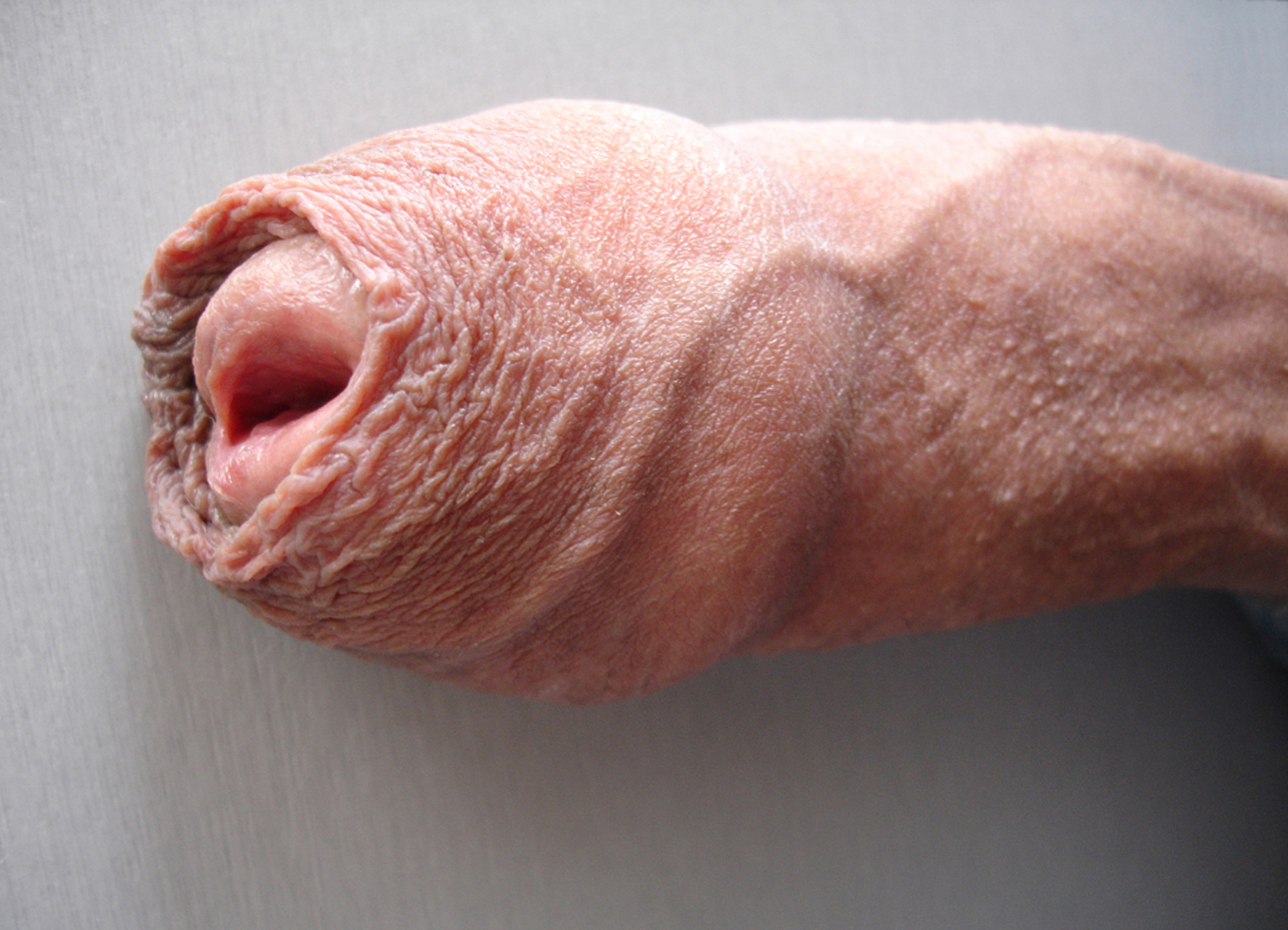 Photo Male Penis 79