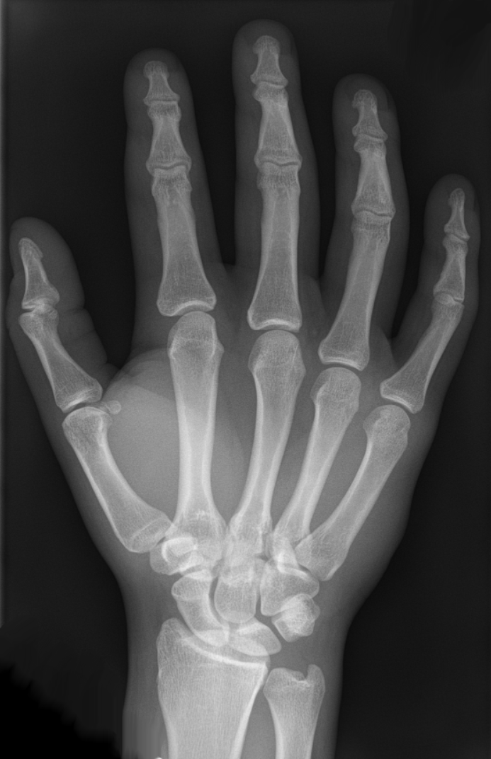 Hand Wikipedia