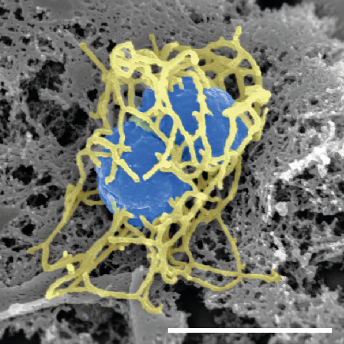 meningitis cell diagram