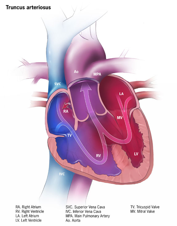 conus arteriosus heart