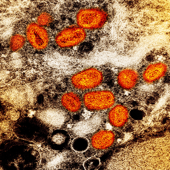 Monkeypox virus - Wikipedia