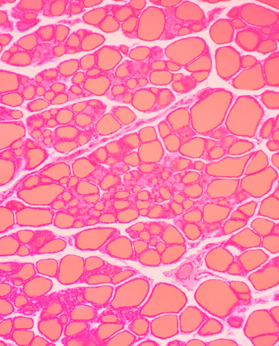 Mikrofotografie tkáně štítné žlázy pořízená pomocí světelného mikroskopu. Jsou na ní oranžově zbarvené útvary, folikuly štítné žlázy.