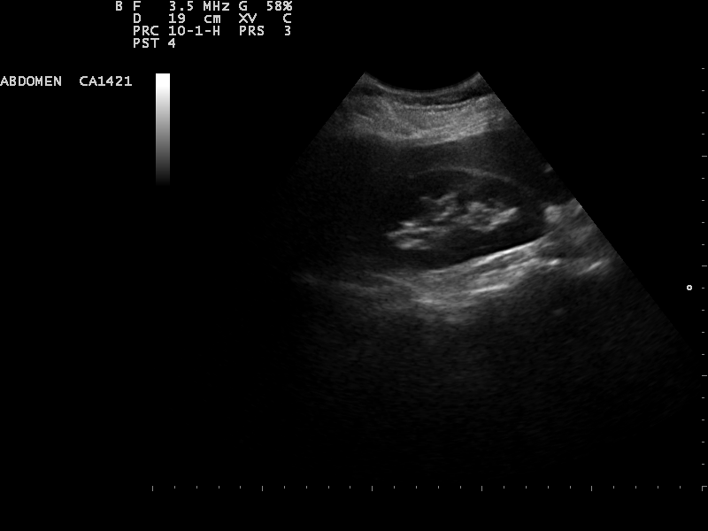 File:Ultrasound Scan ND 0107104902 1052040.png