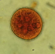 Entamoeba coli cyst with more than four nuclei Entaemoeba coli cyst 6 nuclei.png