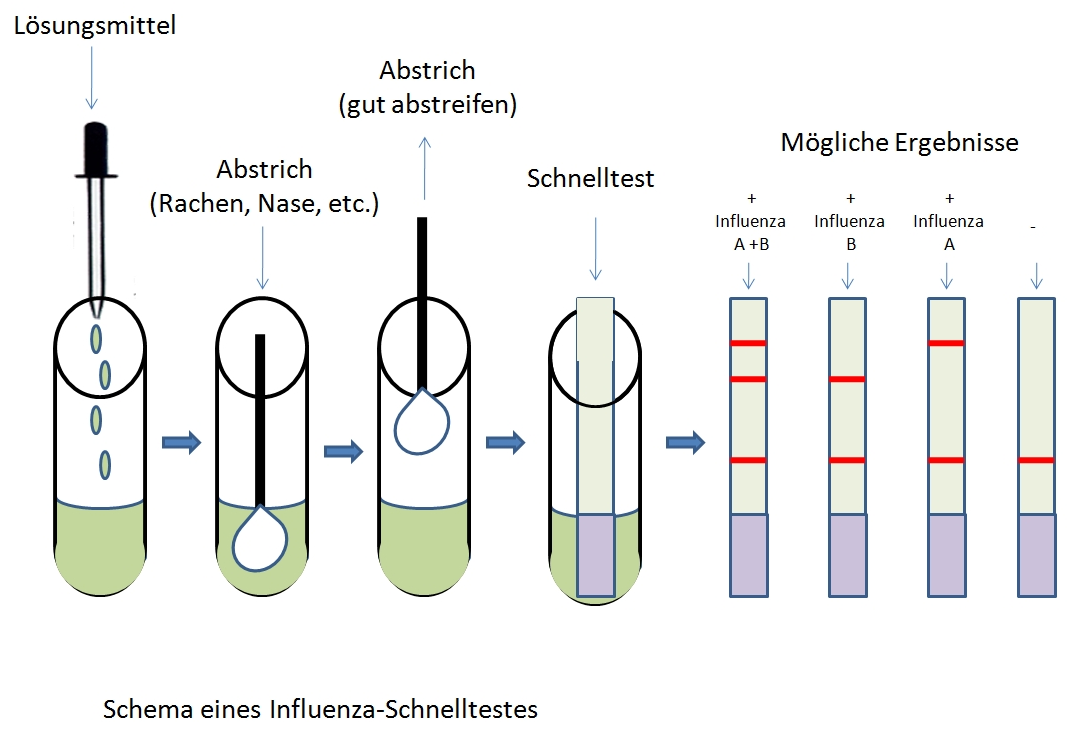 Influenza-Schnelltest – Wikipedia