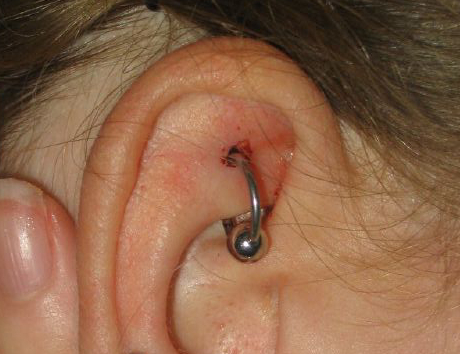 File:New rook piercing.jpg