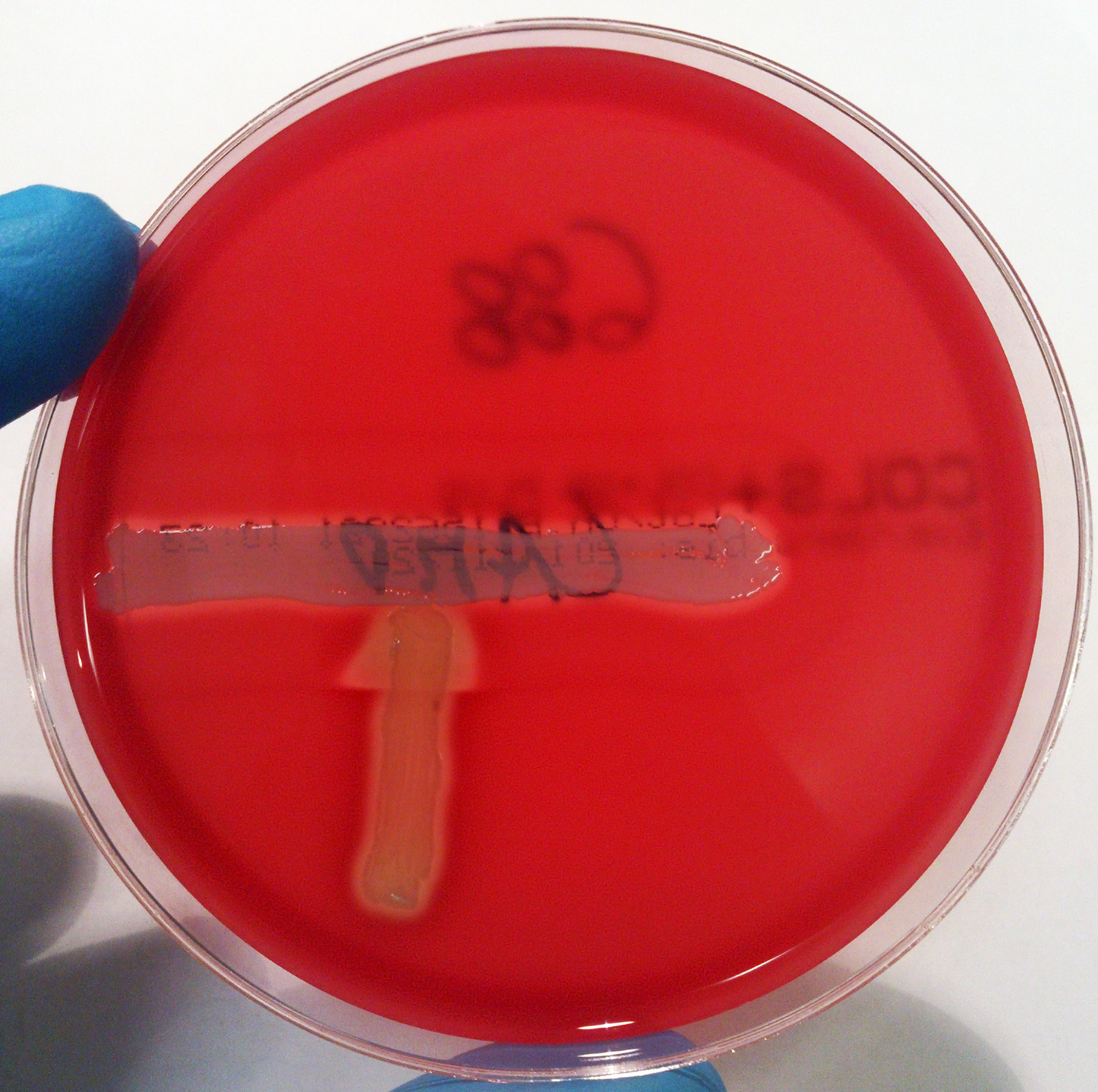 Streptococcus agalactiae у мужчин. Листерия моноцитогенес Камп. Листерия моноцитогенес на кровяном агаре. Камп тест листерии. Camp тест для стрептококков.