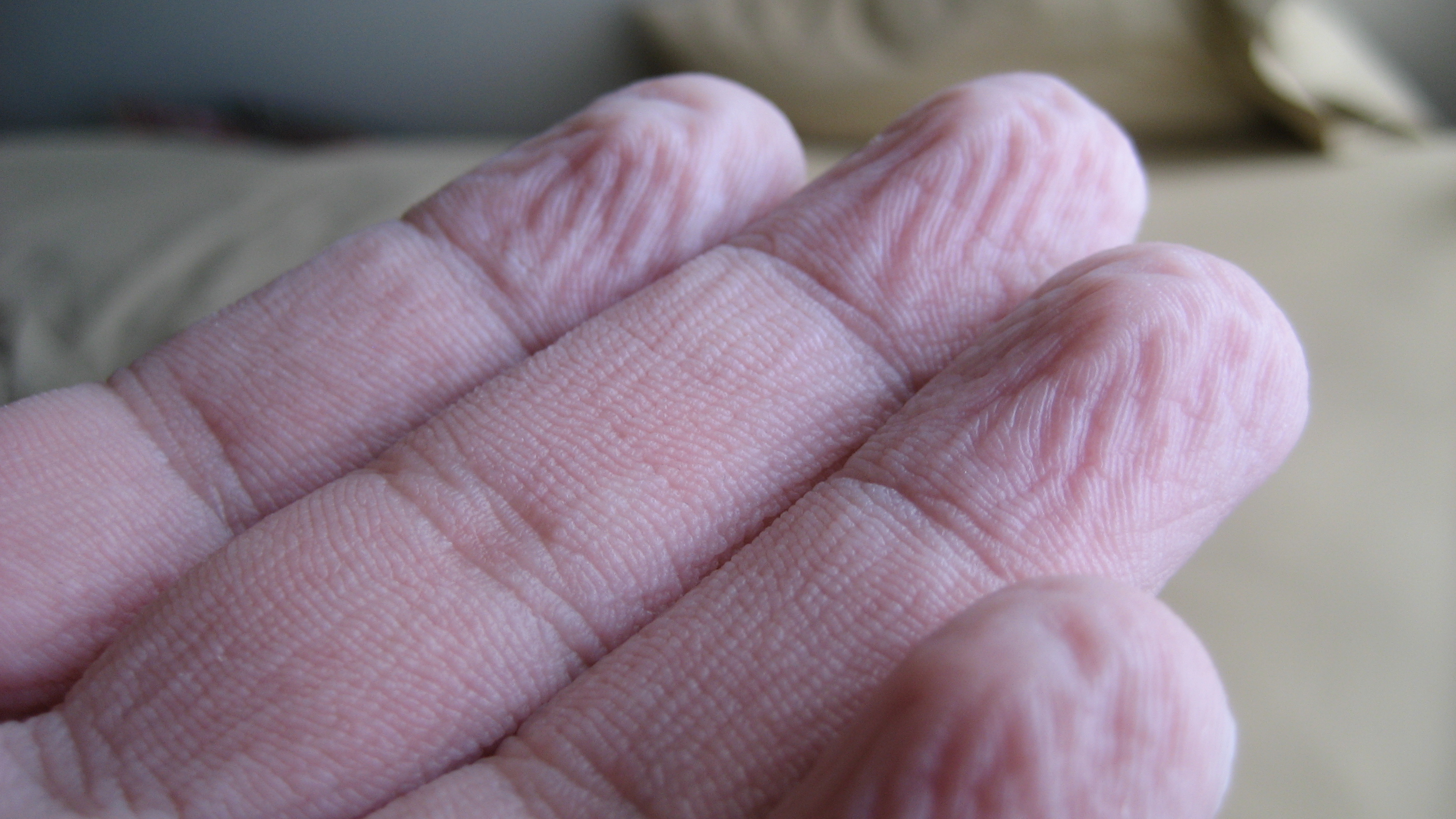 Руки после ванны. Сморщенная кожа на пальцах. Морщинистая кожа от воды.