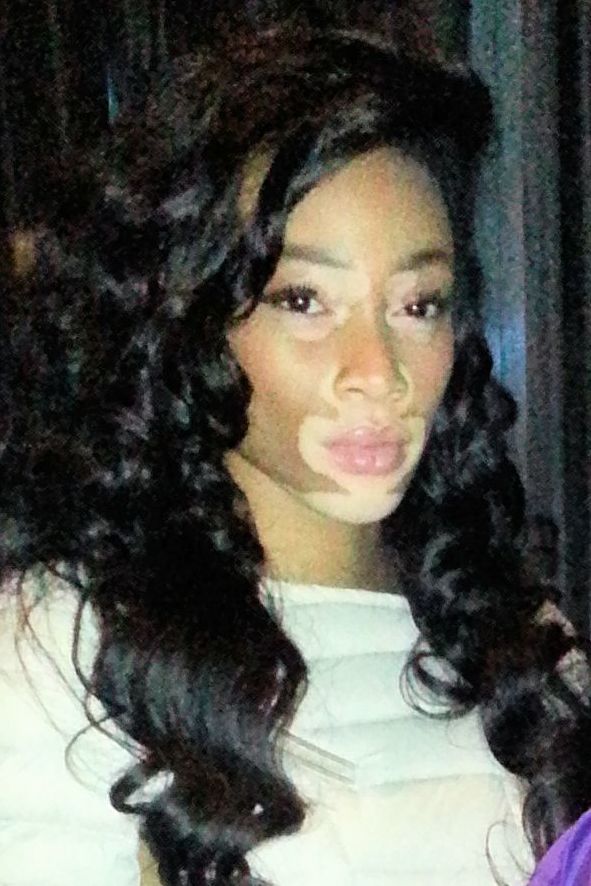 Winnie harlow pictures