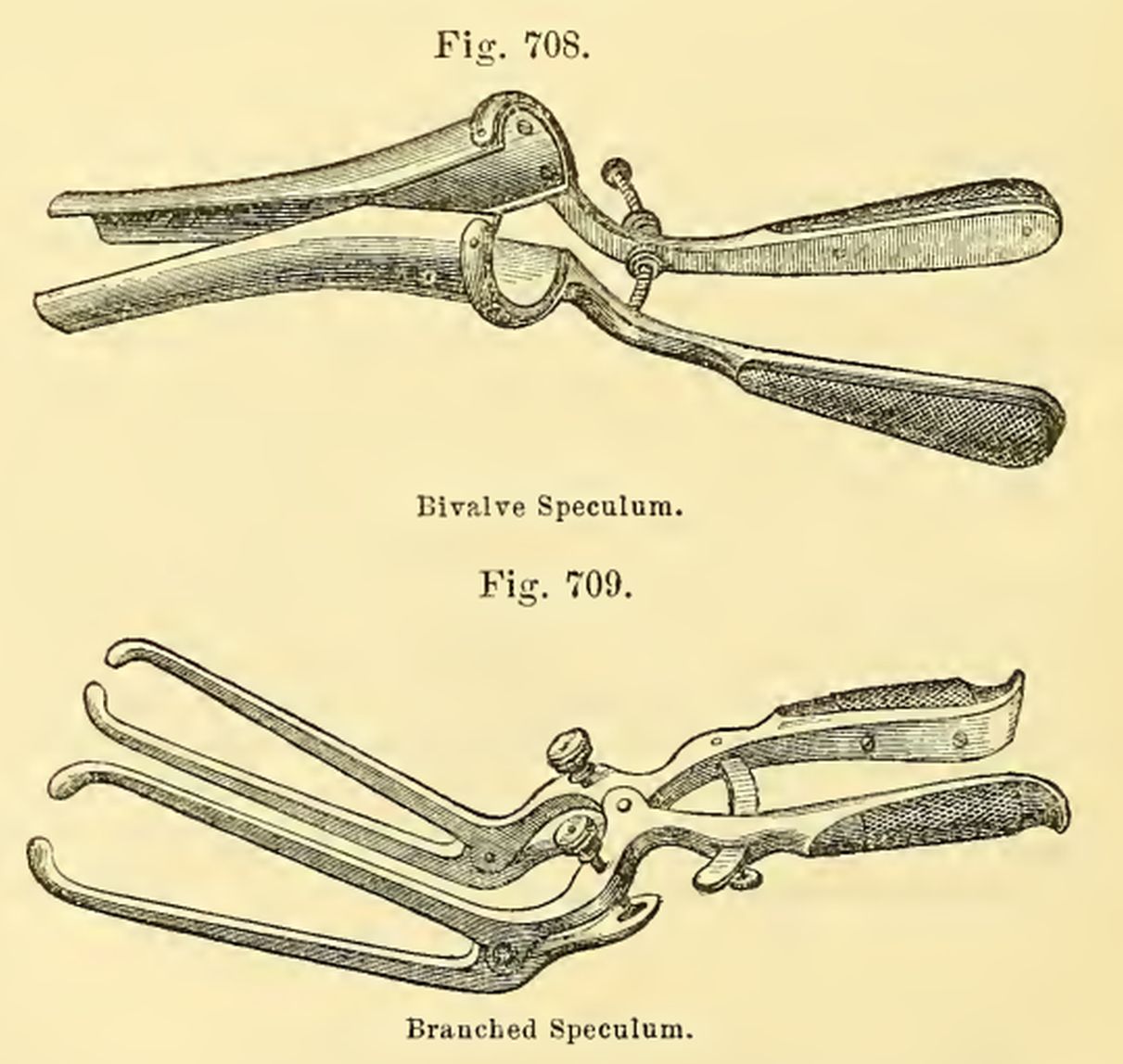 Spekulum – Wikipedia