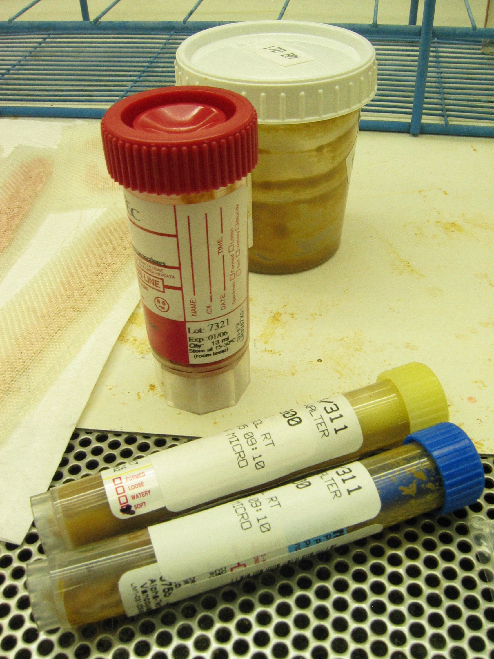 Molecular diagnostics for C. difficile infection: too much of a good thing ...