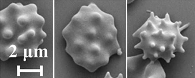 File:Scanning electron microscopy (SEM) of echinocytes.png