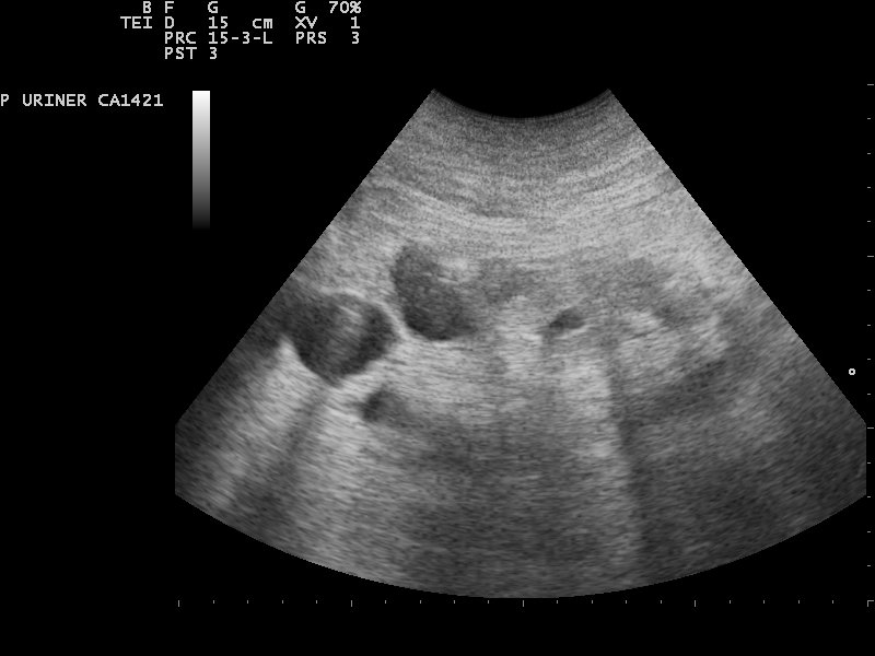 File:Ultrasound Scan ND 110223083601 0836270.jpg