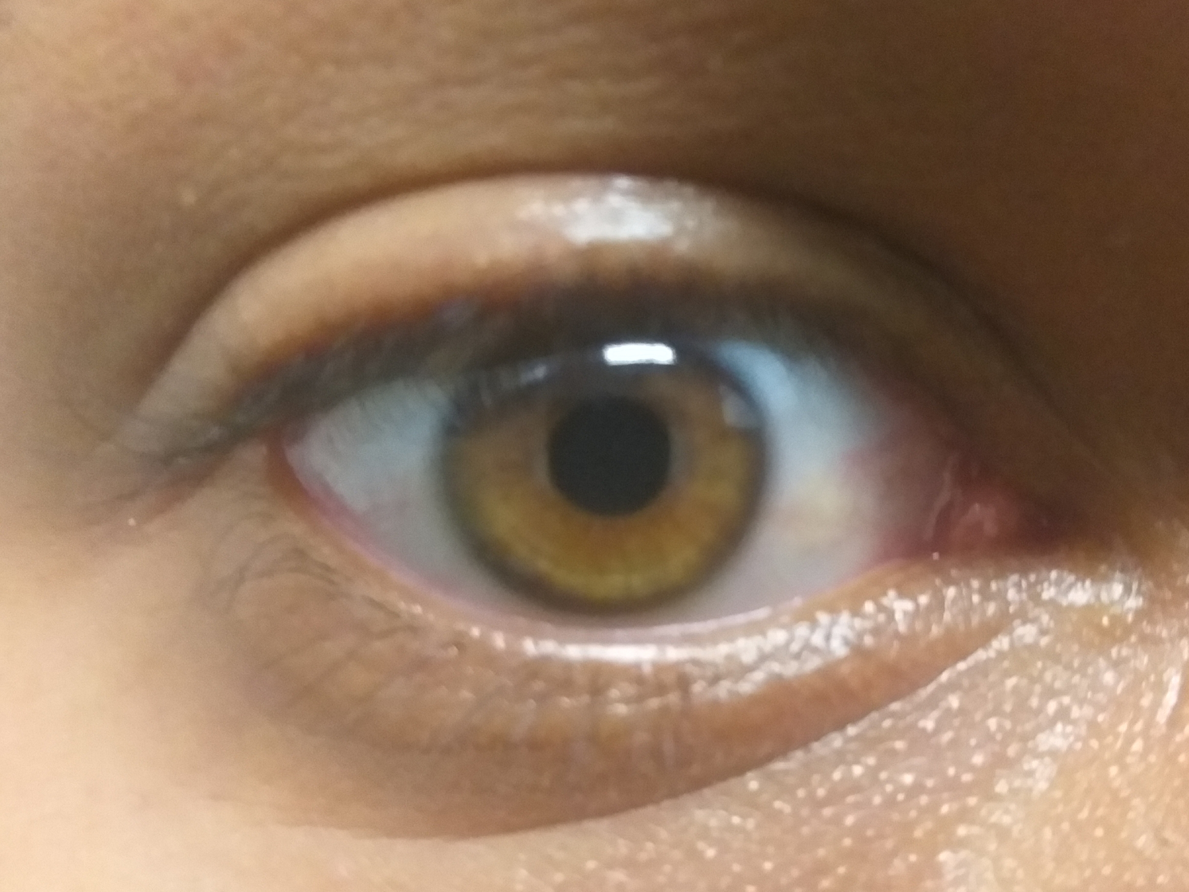 File:Amber-colored-eye.jpg - Wikimedia Commons