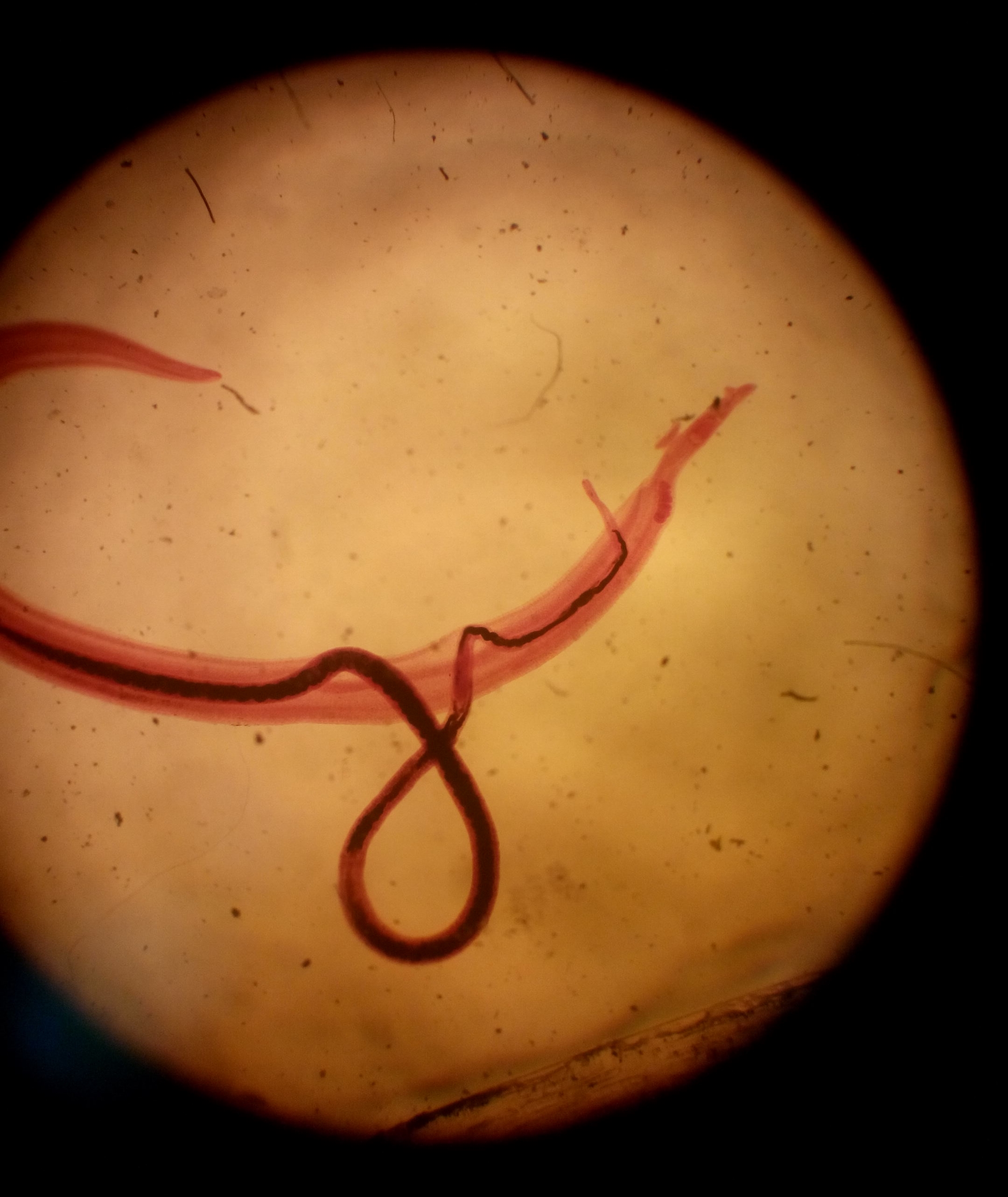 schistosoma mansoni