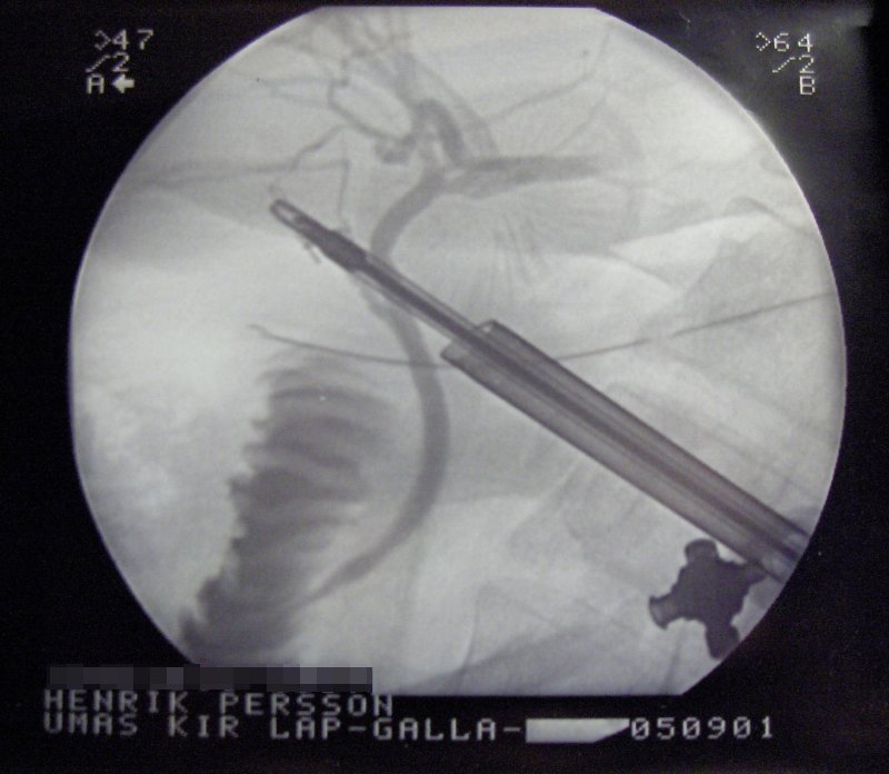 Röntgencső – Wikipédia