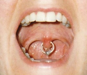 Oral piercing: what are the risks?