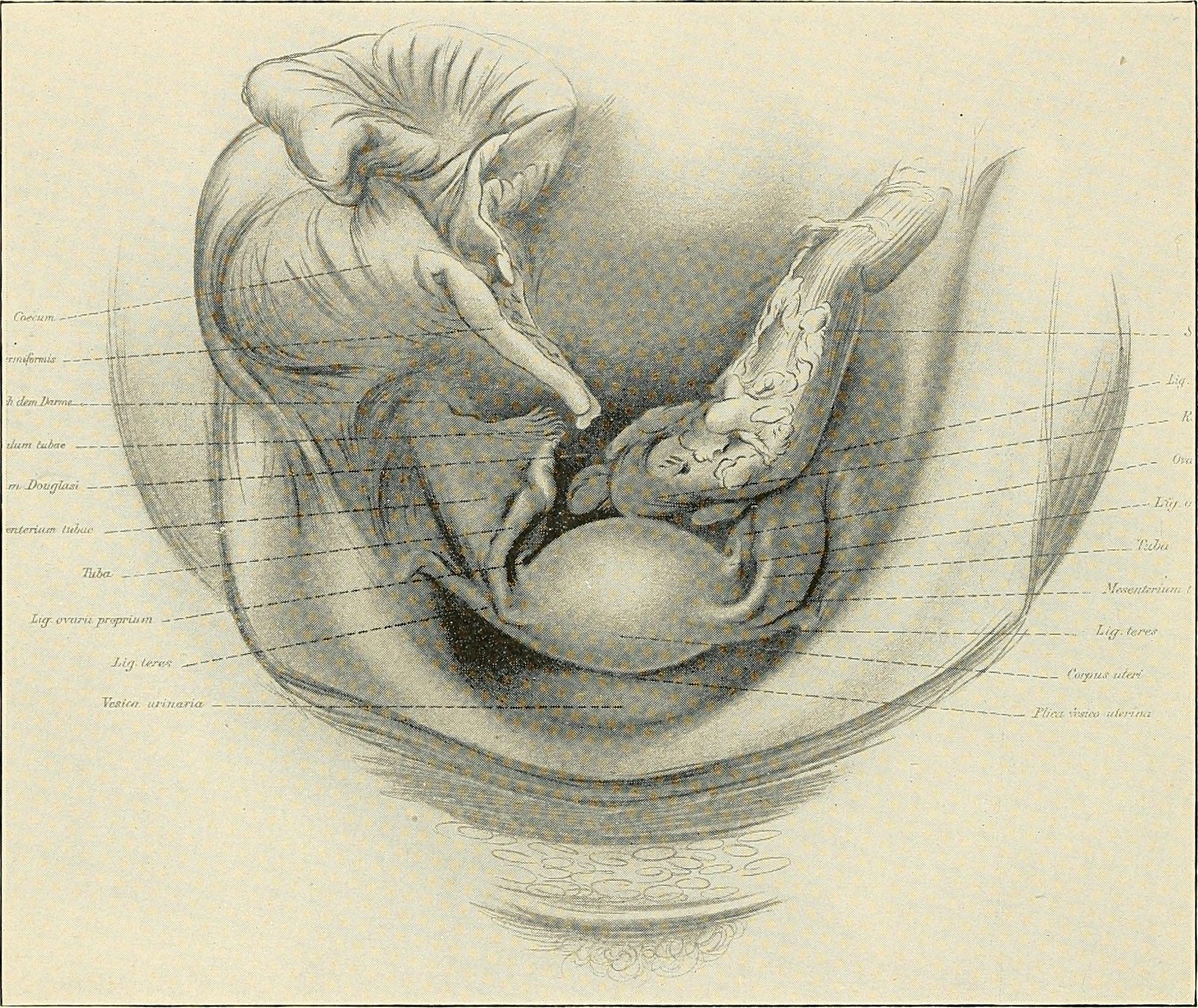 YNTERIUM