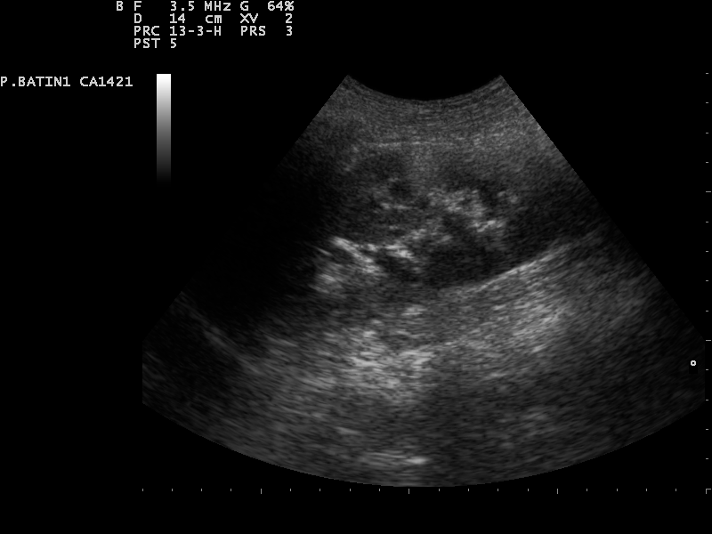 File:Ultrasound Scan ND 0128141905 1420170.png