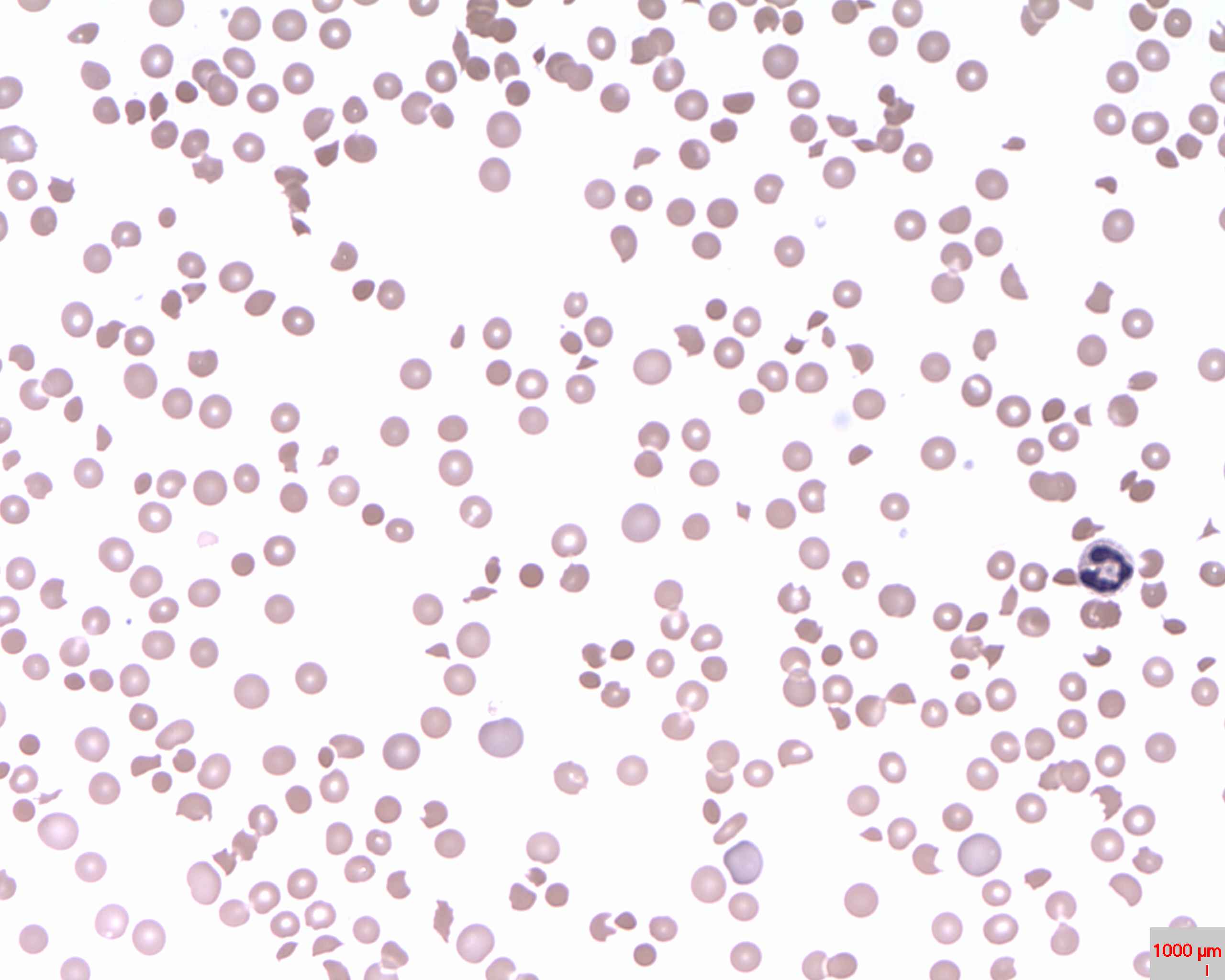 Schistocyte Wikipedia