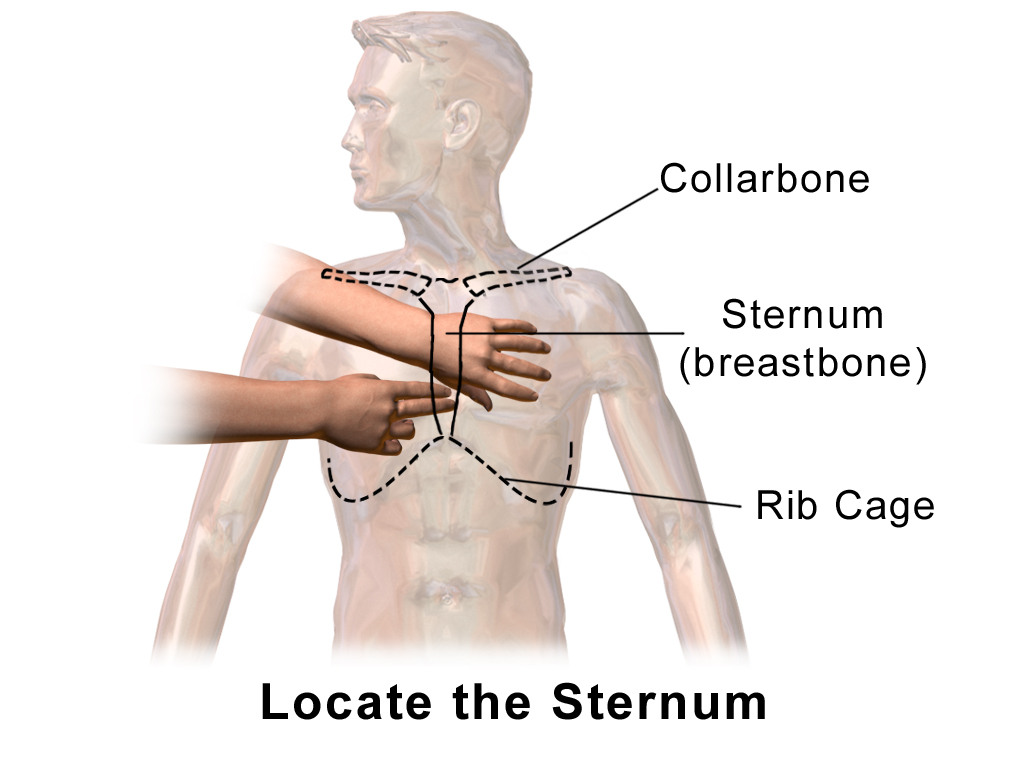 Chest Compressions