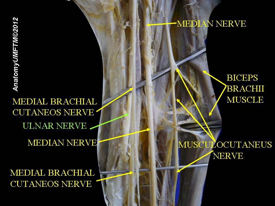 Ulnar nerve - Wikipedia
