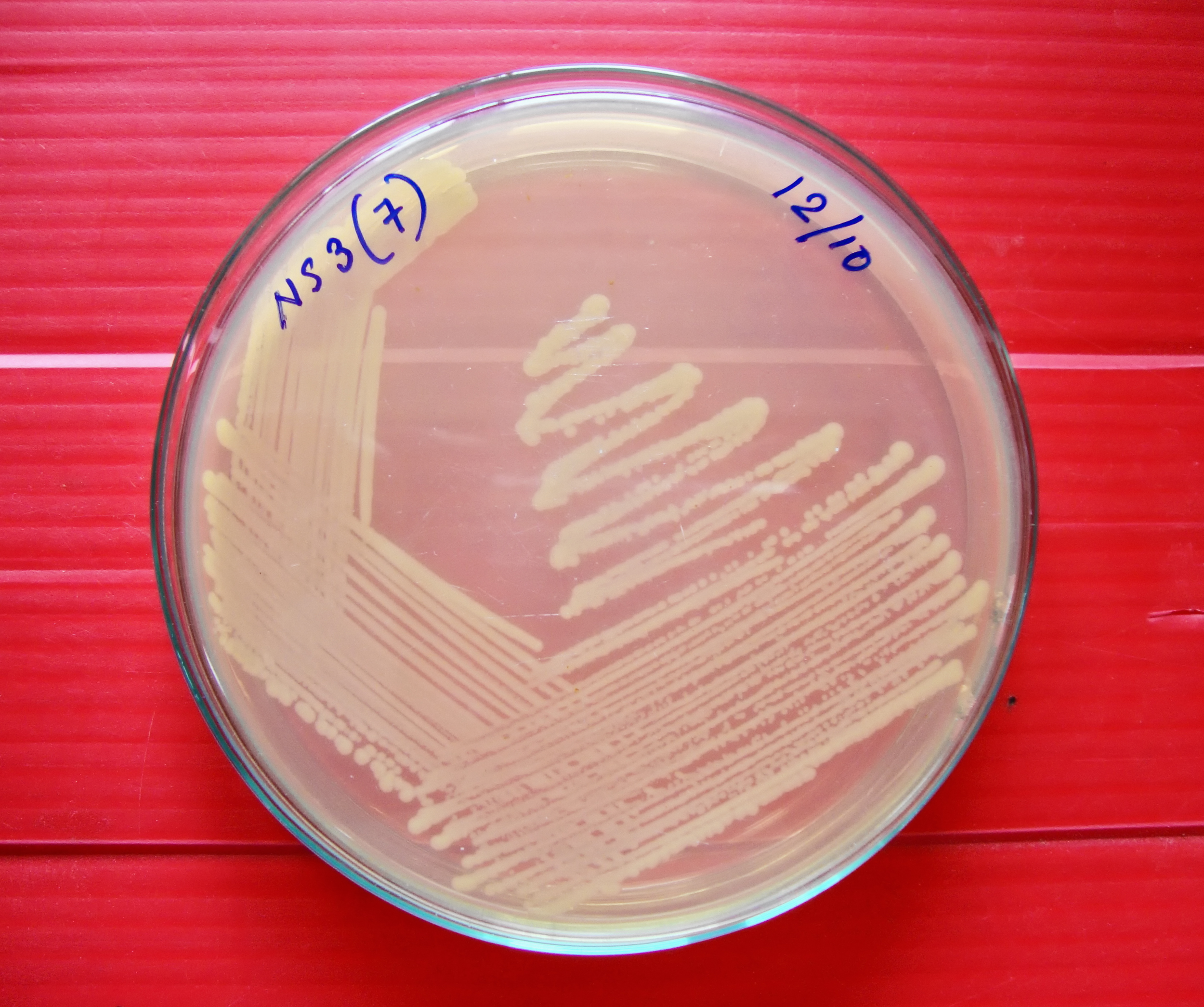 culturing and identifying the ''Salmonella enterica Typhi'' bacterium