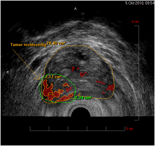 HistoScanning Querschnitt