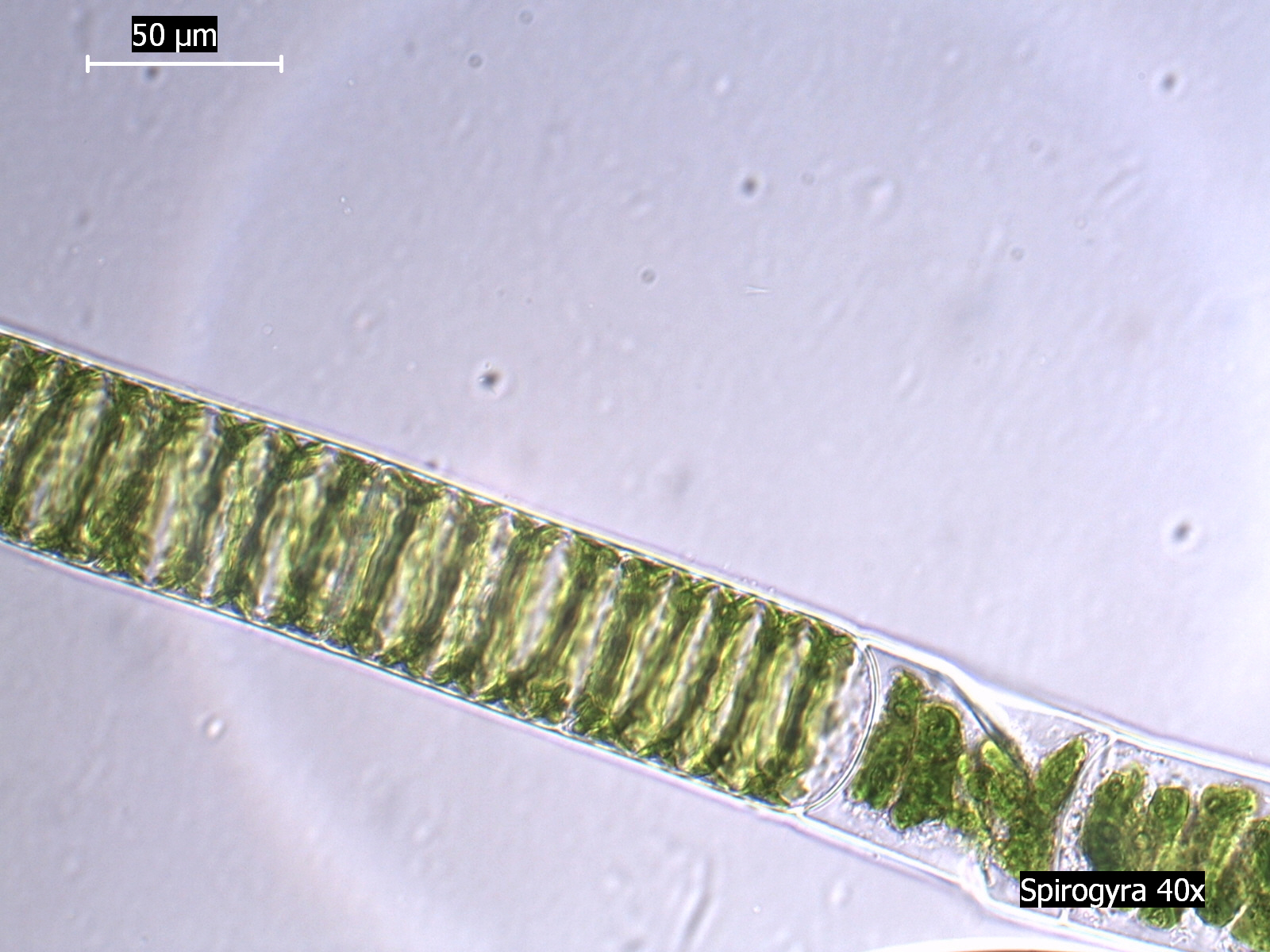 Спирогира в микроскопе
