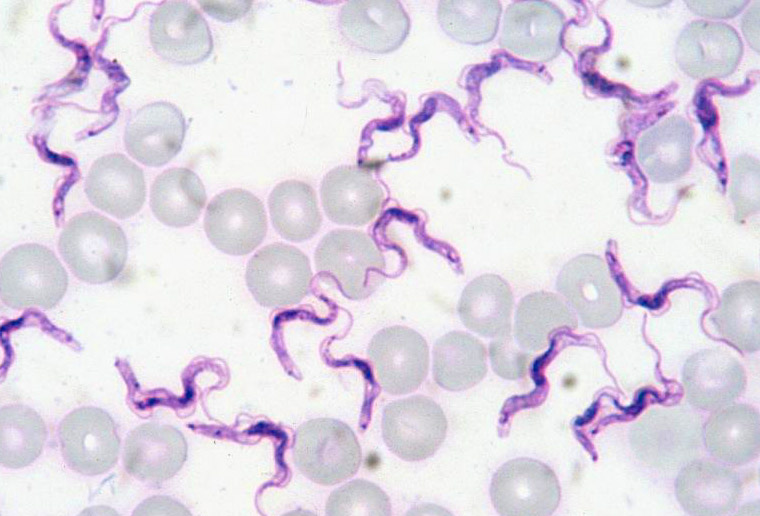 File:Trypanosoma-evansi-rat-blood-Giemsa-stain.jpg - Wikimedia Commons