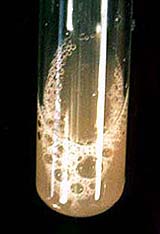 FIP effusive fluid Pleural effusion from a cat with feline infectious peritonitis.jpg