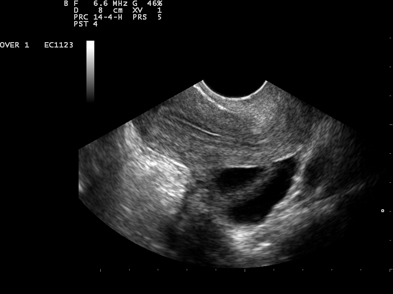 File:Ultrasound Scan ND 0124144905 1456150.png