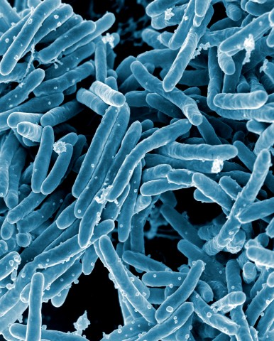 File:Mycobacterium tuberculosis Bacteria (16843981465).jpg