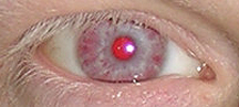 File:Red (albino) eye.png