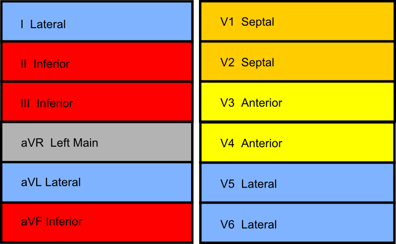 File:MI colours en (CardioNetworks ECGpedia).png