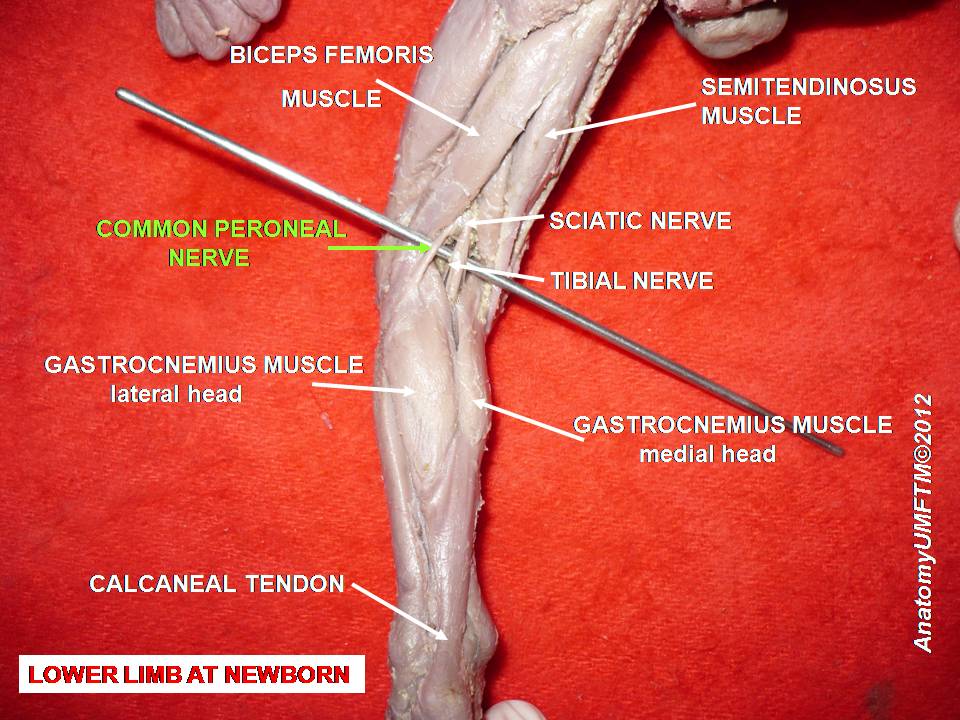 common peroneal nerve