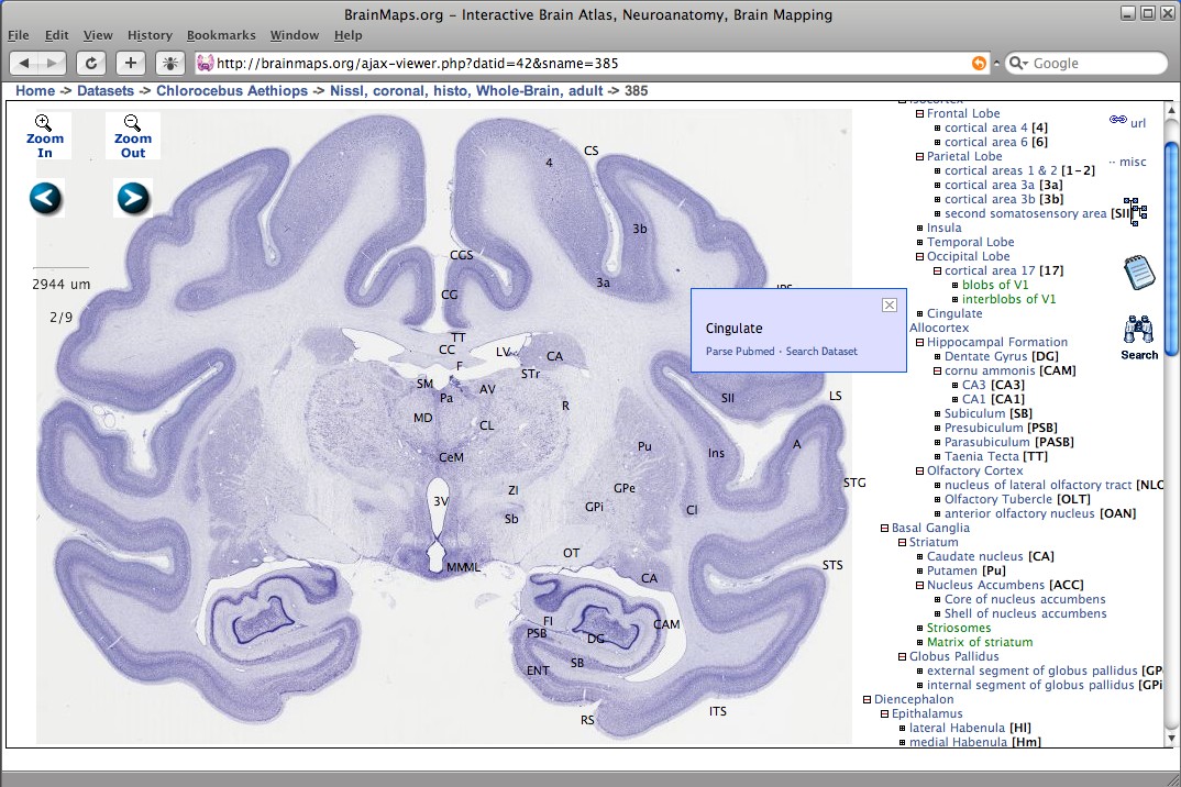 New brain atlas offers comprehensive map of the human brain