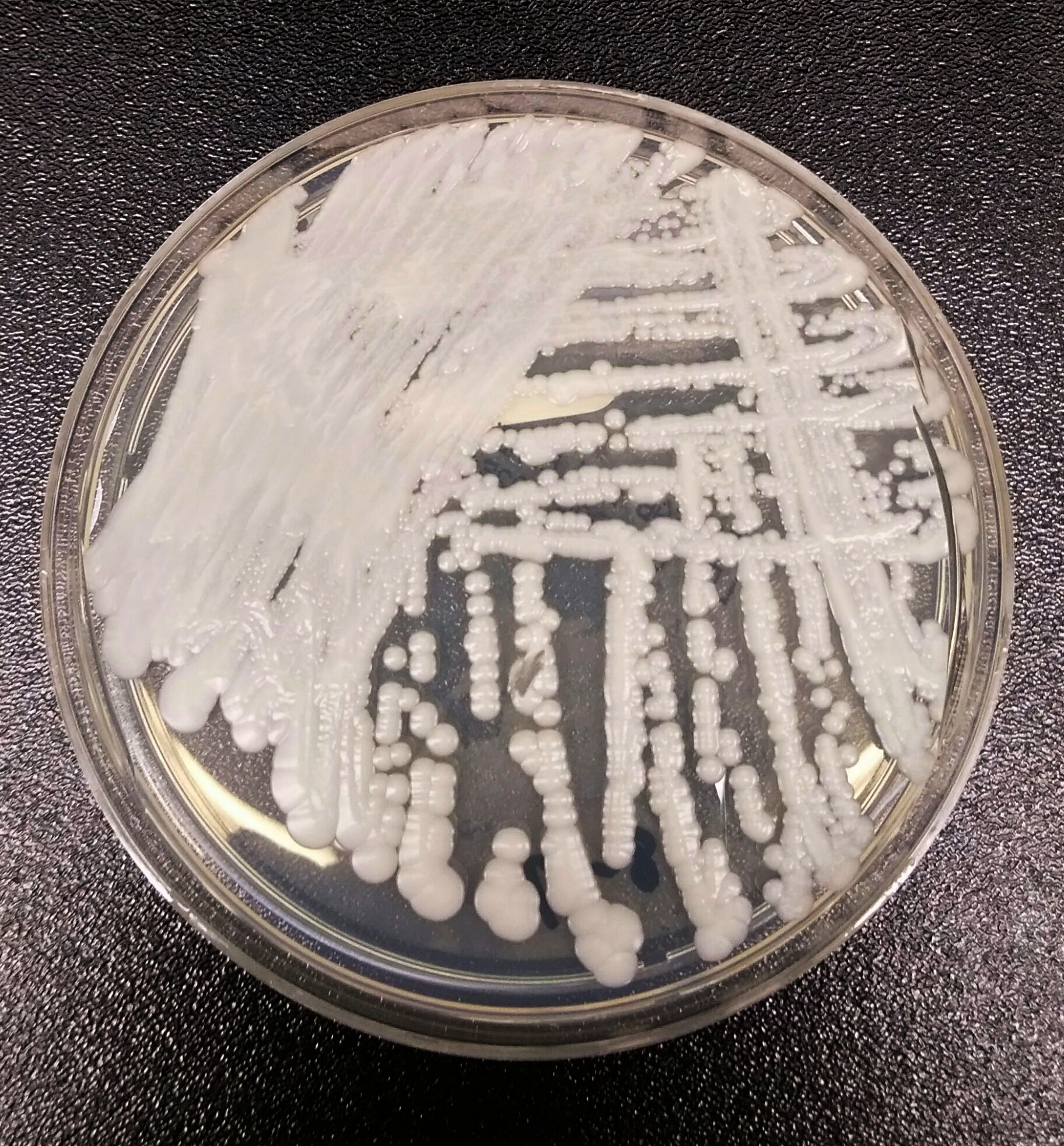 Candida auris - Wikipedia