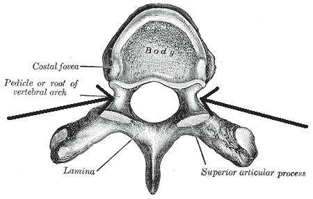 File:Pediculusarcusvertebrae.png