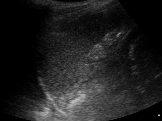 File:Ultrasound Scan ND 104359 1047180 cr.png