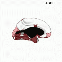 File:Brain maturation ages 8-14.gif