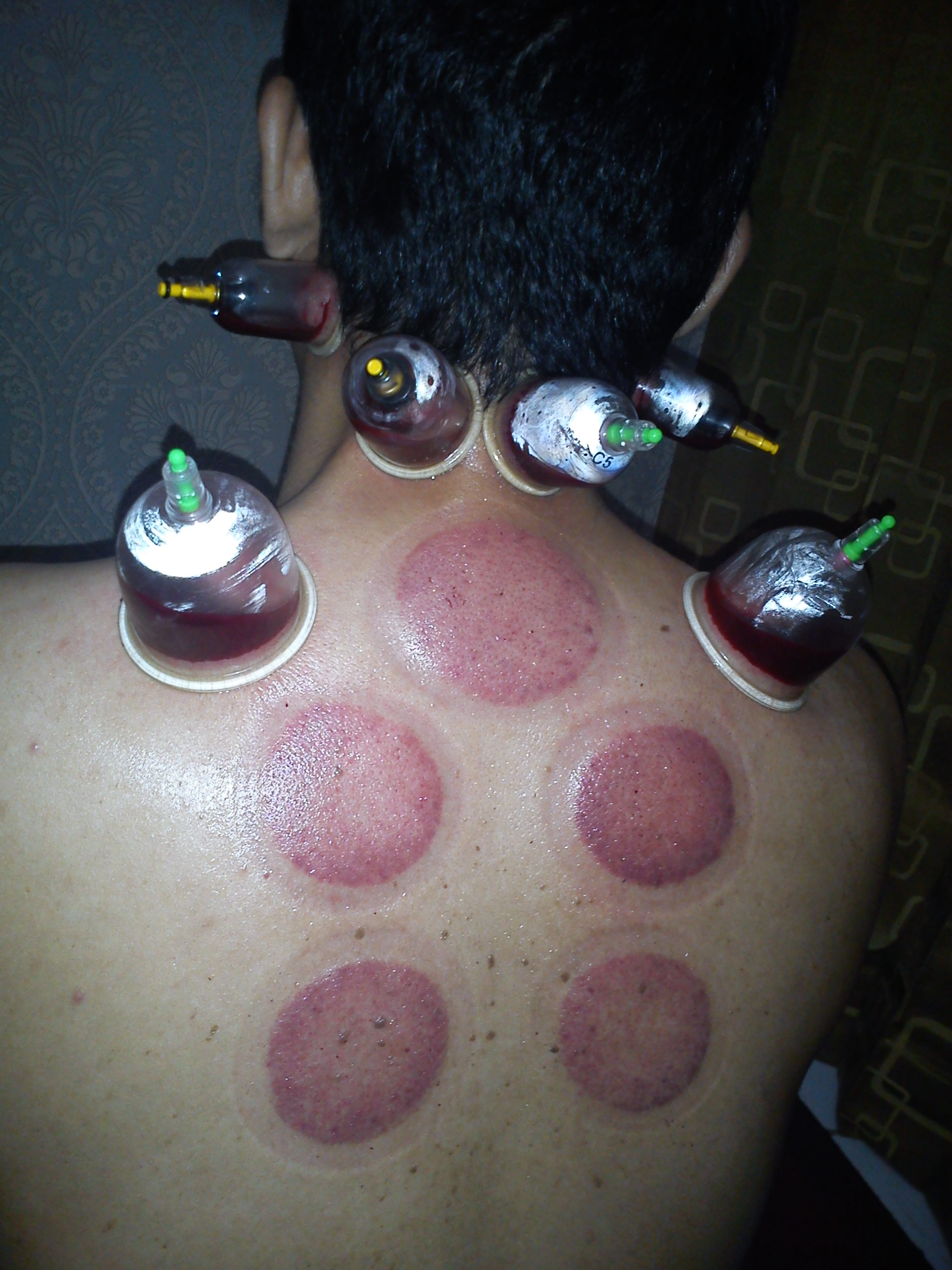 Curso de Cupping con Fuego