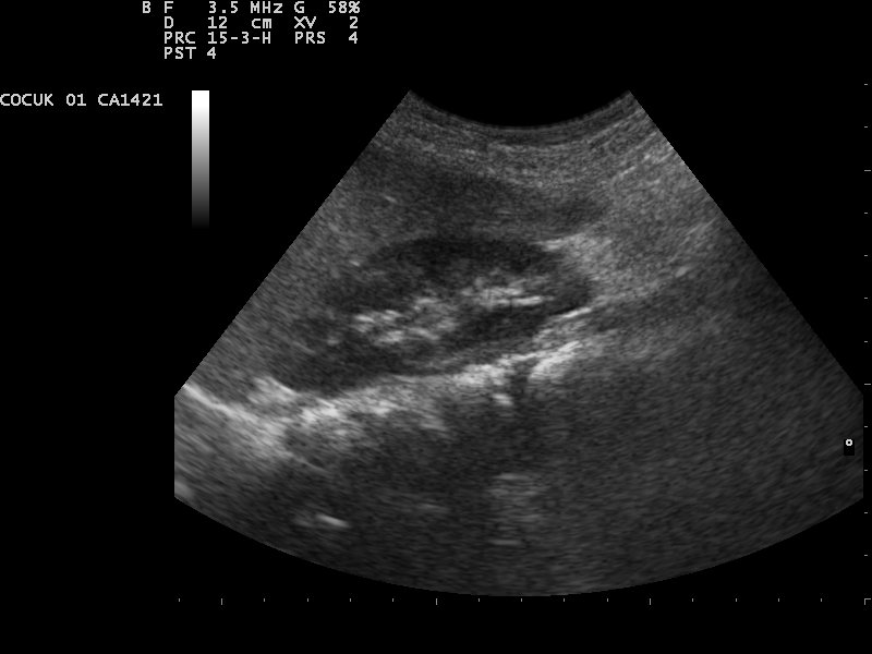 File:Ultrasound Scan ND 110208105145 1054300.jpg