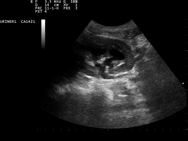 File:Ultrasound Scan ND 0106110625 1110000.png