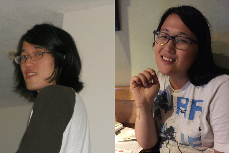 File:MTF hormone replacement therapy before after.png - Wikipedia