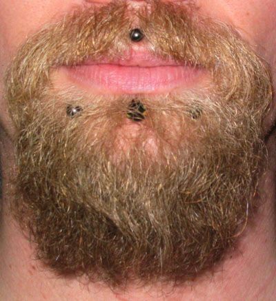 File:Labret,meduza, snakebite.jpg