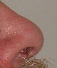 File:Nose.agr.jpg