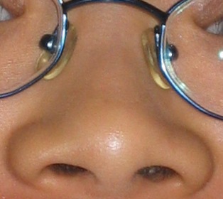 File:Nose with glasses.jpg