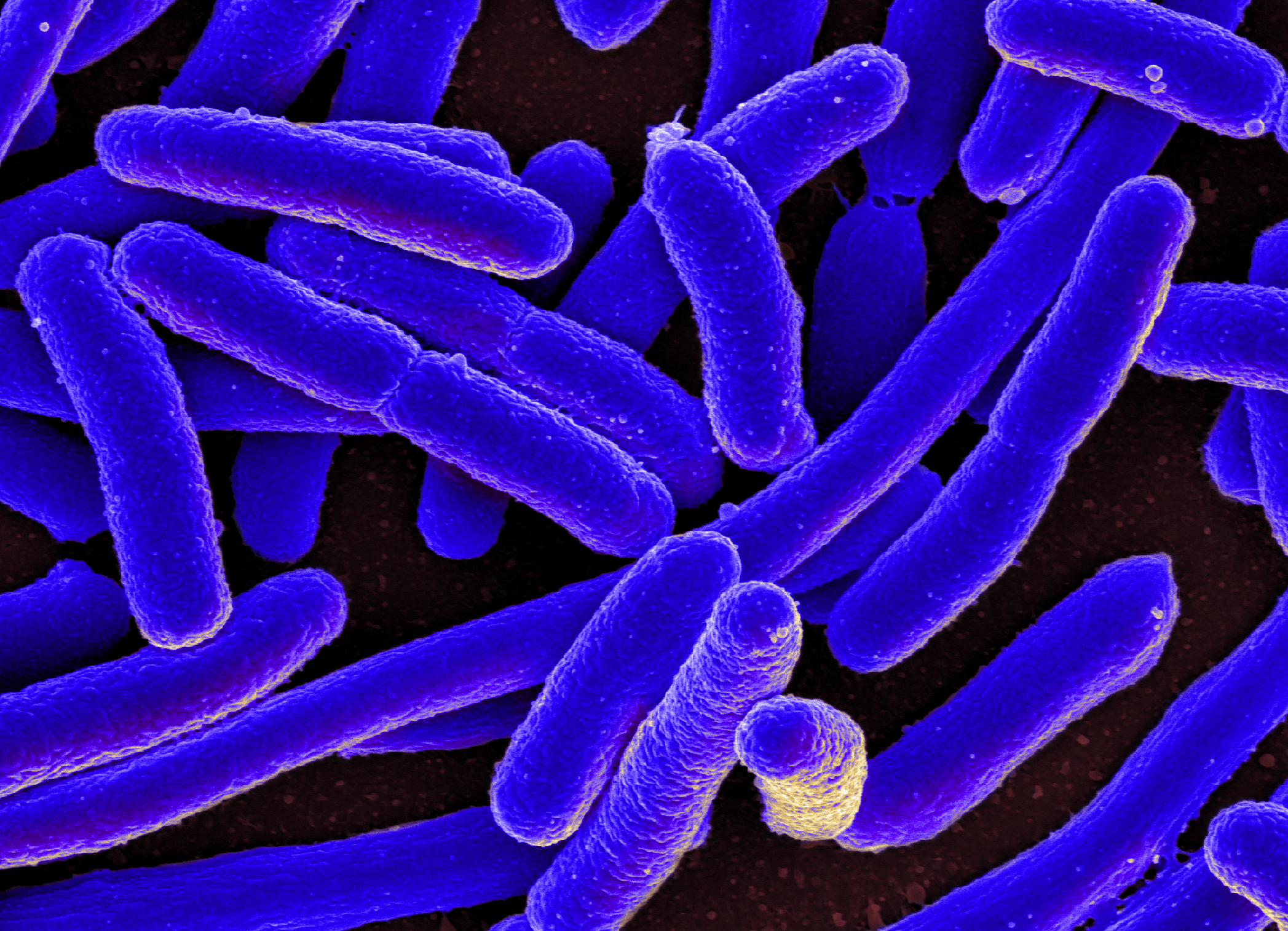 FileE. coli Bacteria (16578744517).jpg Wikimedia Commons